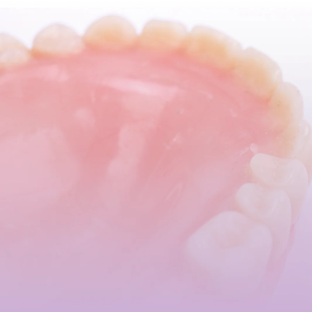 Dentadura, a prótese total removível, na Contreras Odontologia em Curitiba